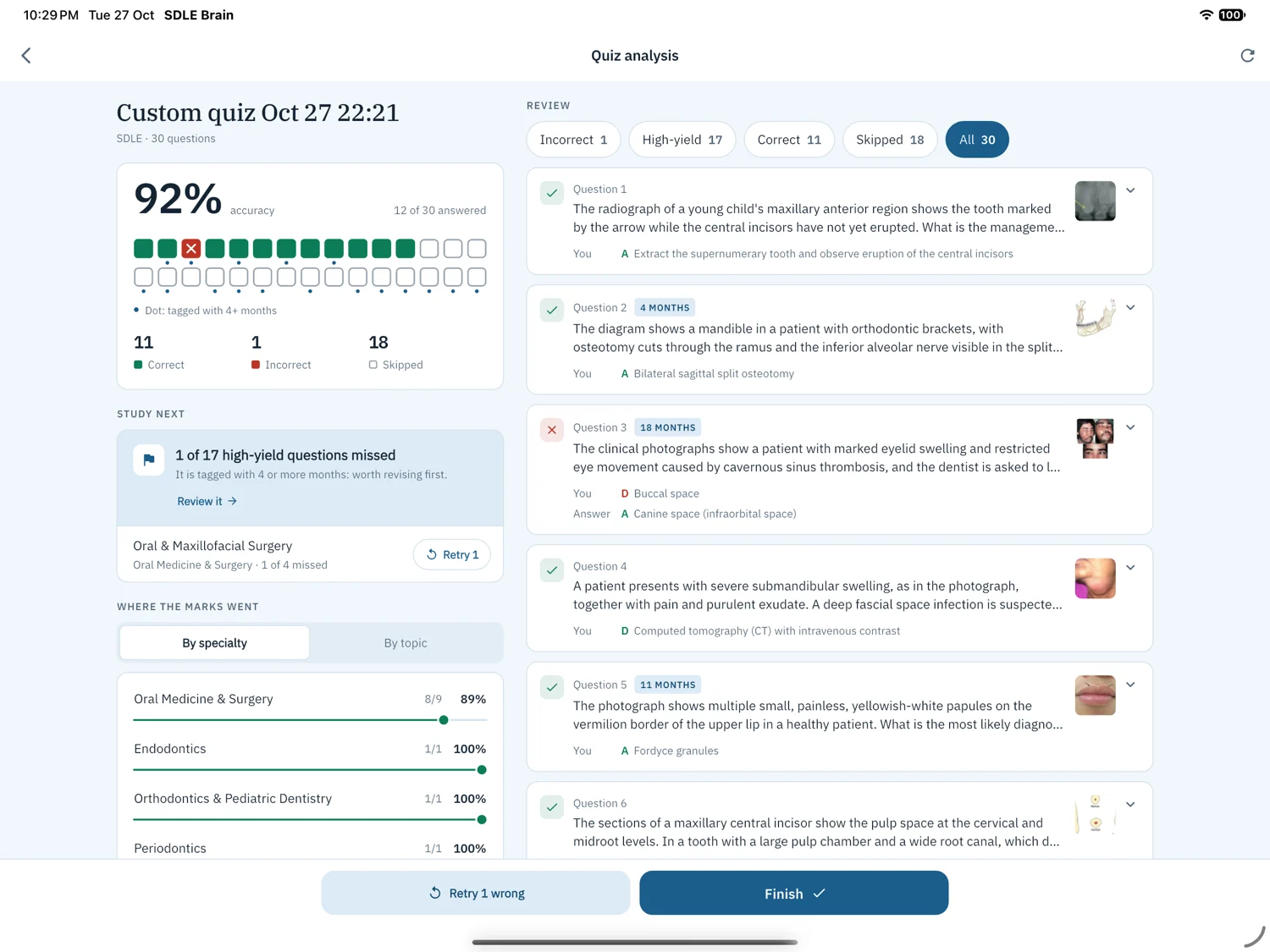 Quiz analysis on iPad: accuracy, what to study next and the list of questions to review