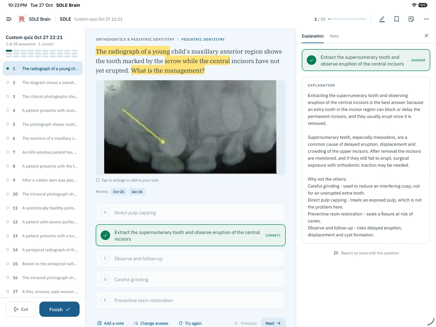 SDLE Brain on iPad: a radiograph question with highlighted words, and its explanation in the panel beside it