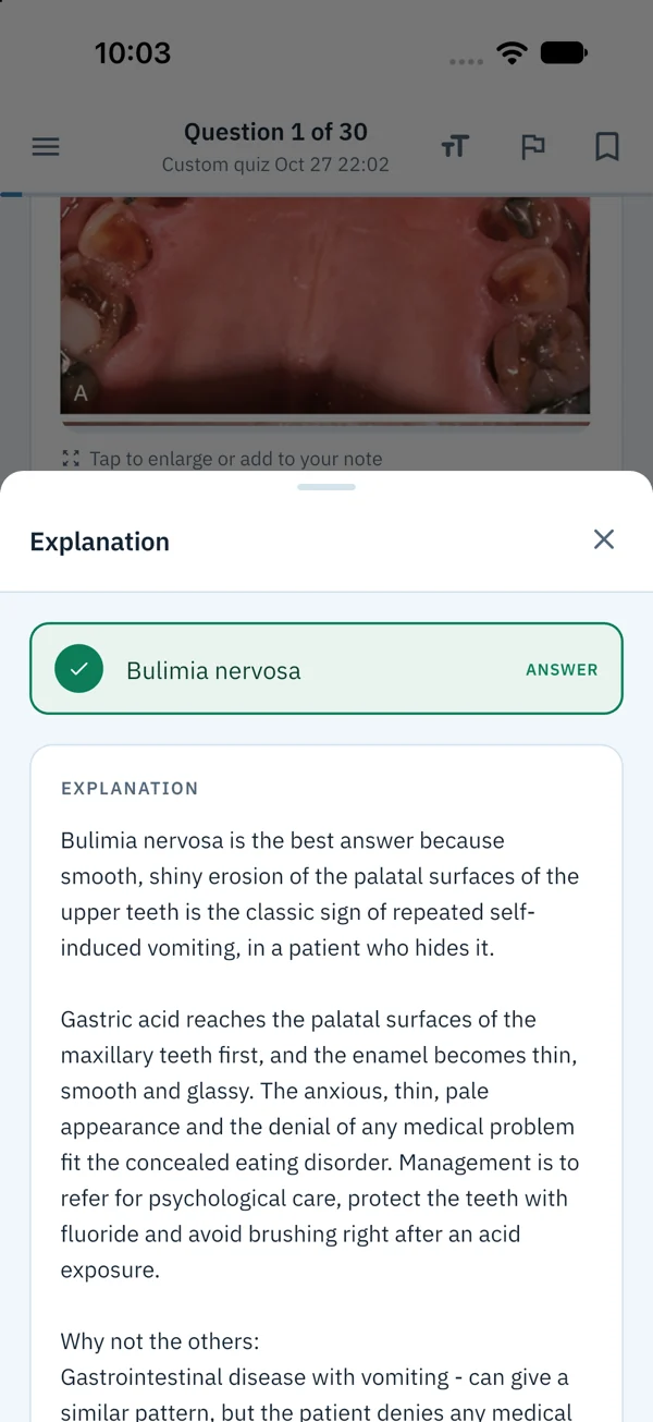 The explanation sheet on iPhone, for a question whose answer is bulimia nervosa