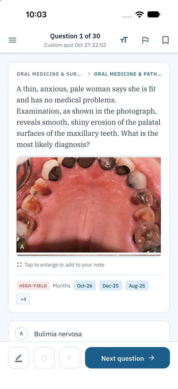 SDLE Brain on iPhone: an oral medicine question with a clinical photograph of the palate
